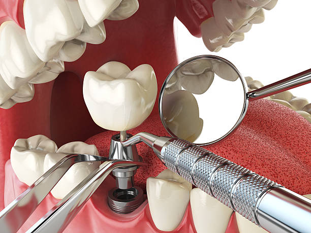 Best 24-Hour Emergency Dental Care in Davisboro, GA